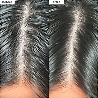 Scalp Revival Charcoal + Biotin Dry Shampoo