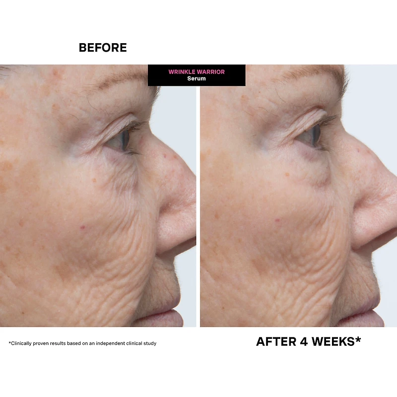 Wrinkle Warrior™ 2-in-1 Plumping Moisturizer + Hyaluronic Serum