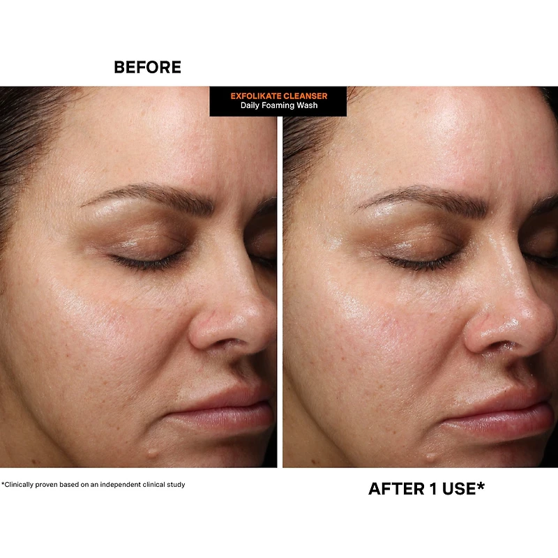 ExfoliKate™ Cleanser Daily Foaming Wash with AHA & Enzymes