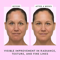 T.L.C. Masque Sukari Babyfacial™ AHA + BHA