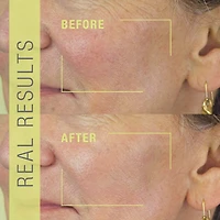 Vaporisateur exfoliant Stem Cellular®