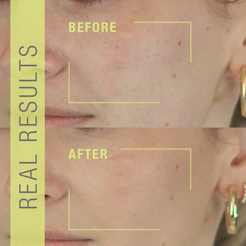 Vaporisateur exfoliant Stem Cellular®