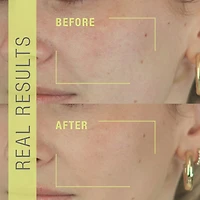 Vaporisateur exfoliant Stem Cellular®