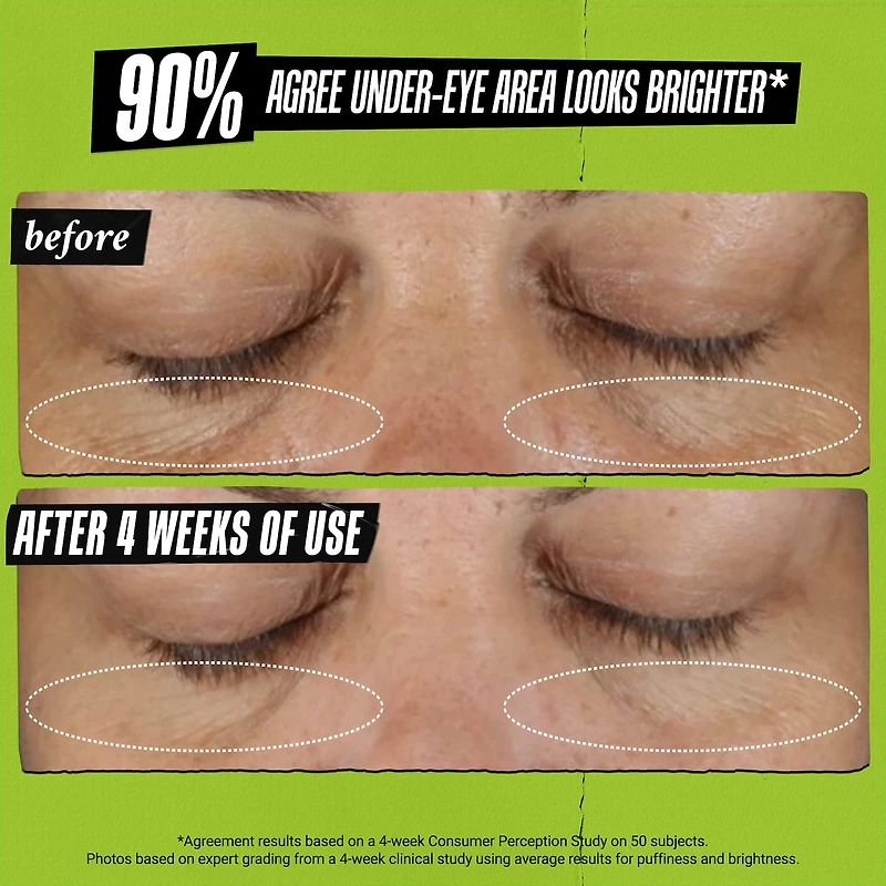 Hydrating Eye Treatment Cream with Avocado