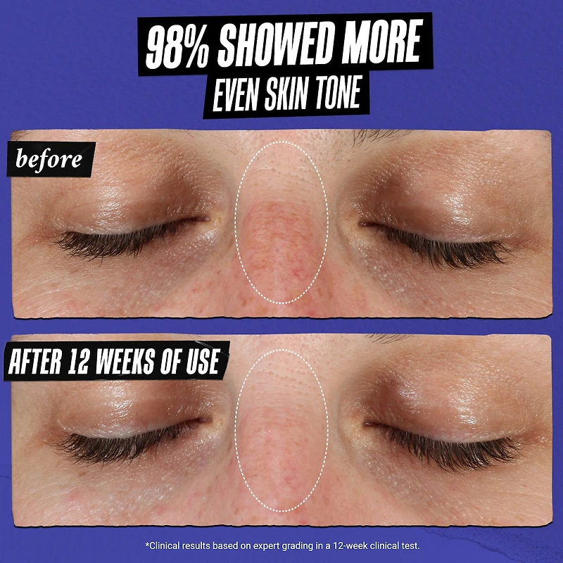 Clearly Corrective™ Dark Spot Correcting Serum with Vitamin C