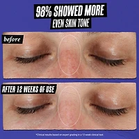 Clearly Corrective™ Dark Spot Correcting Serum with Vitamin C
