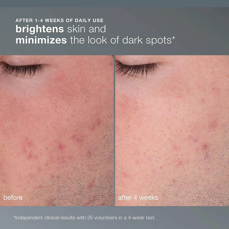 Exfoliant rechargeable Daily Microfoliant