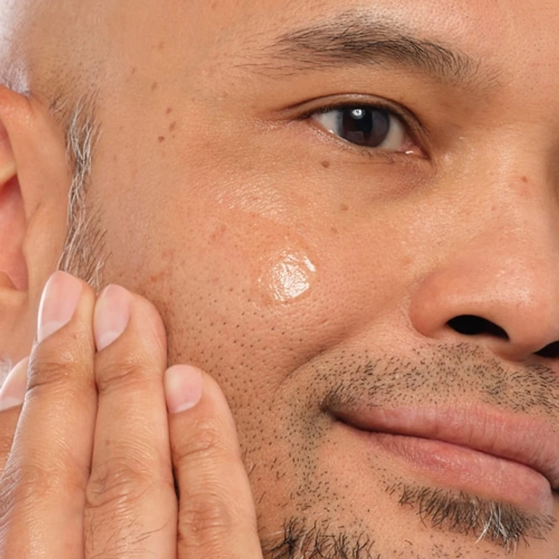 Alpha Arbutin 2% + Hyaluronic Acid for Hyperpigmentation