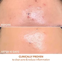 Masque DRx SpectraLite™ FaceWare Pro