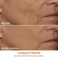 DRx SpectraLite™ FaceWare Pro