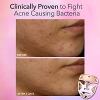 DRx SpectraLite™ FaceWare Pro 3-Minute LED Device