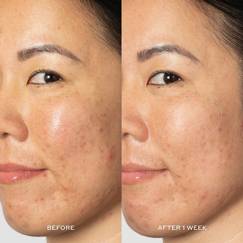 Lotion tonique exfoliant anti-tache pigmentaire Glow2OH avec AHA à 7 %
