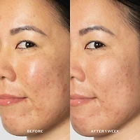 Lotion tonique exfoliant anti-tache pigmentaire Glow2OH avec AHA à 7 %