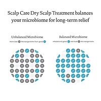 Scalp Care Dry Scalp Treatment