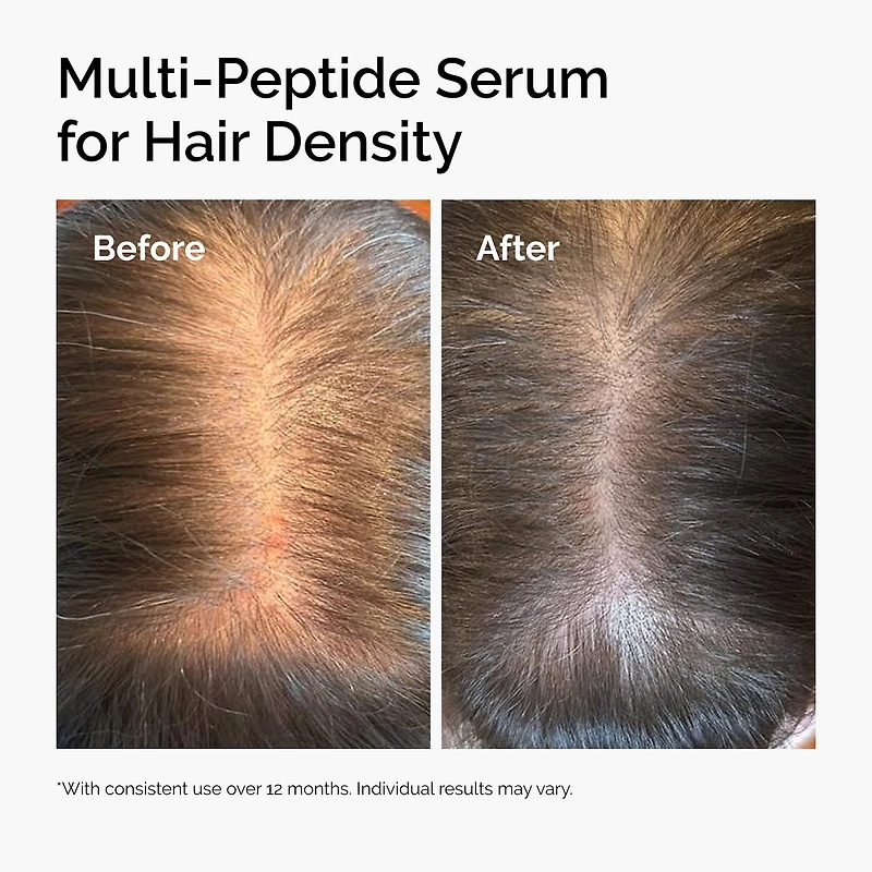 Multi-Peptide Serum for Hair Density for Thicker, Fuller Looking Hair