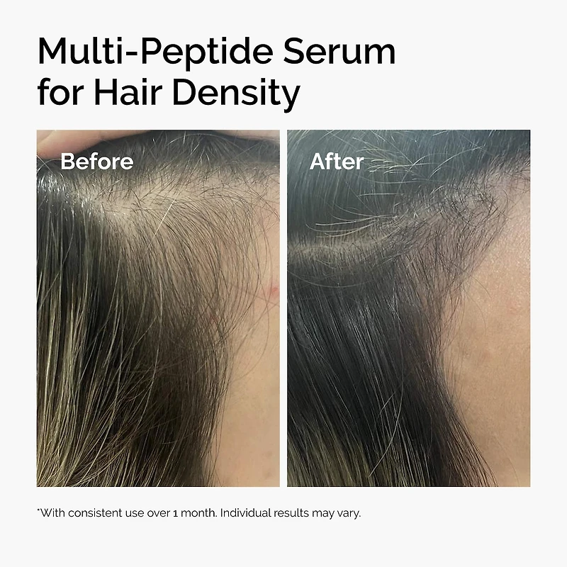 Multi-Peptide Serum for Hair Density for Thicker, Fuller Looking Hair