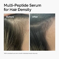 Multi-Peptide Serum for Hair Density for Thicker, Fuller Looking Hair