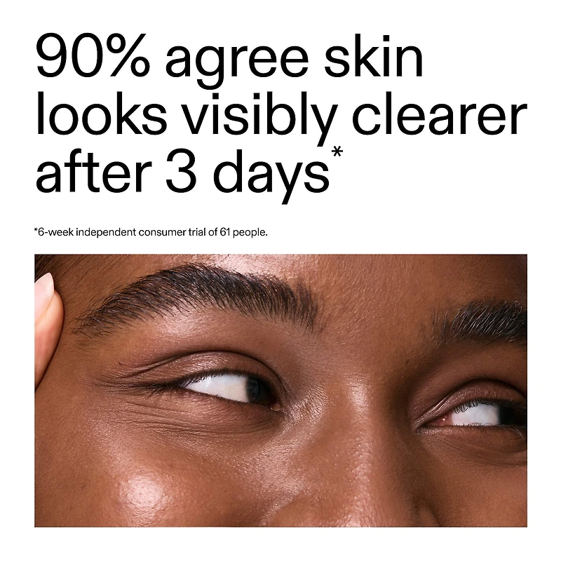 Salicylic Acid Acne + Blackhead Cleanser