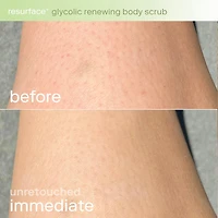 Resurface+ Glycolic and Lactic Acid Renewing Body Scrub