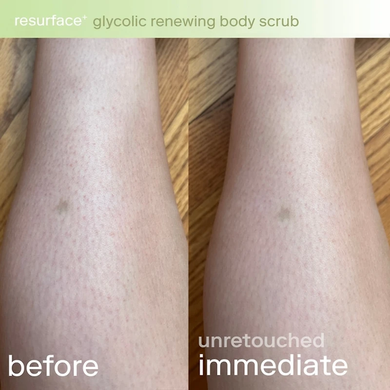 Resurface+ Glycolic and Lactic Acid Renewing Body Scrub