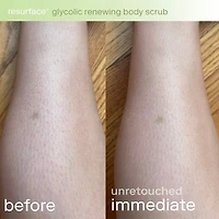 Resurface+ Glycolic and Lactic Acid Renewing Body Scrub