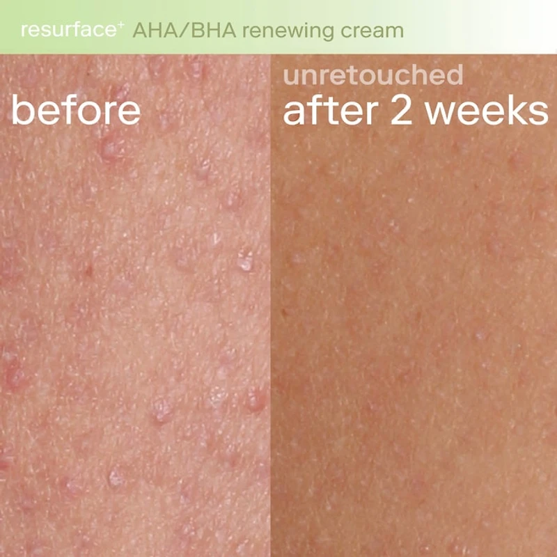 Resurface+ AHA Renewing Body Cream