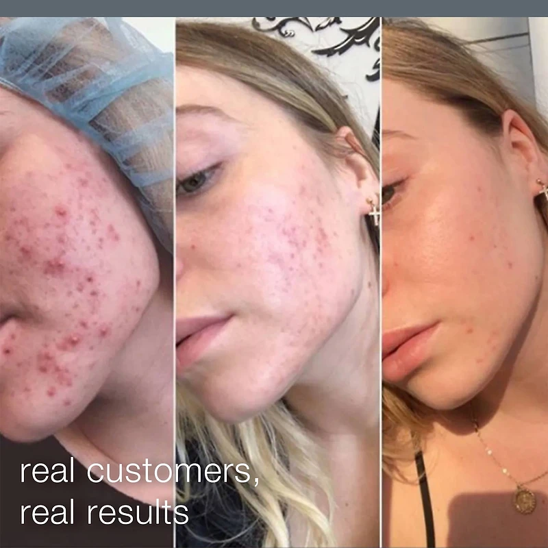 Daily Microfoliant Refillable Exfoliator