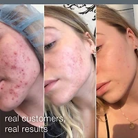 Daily Microfoliant Refillable Exfoliator
