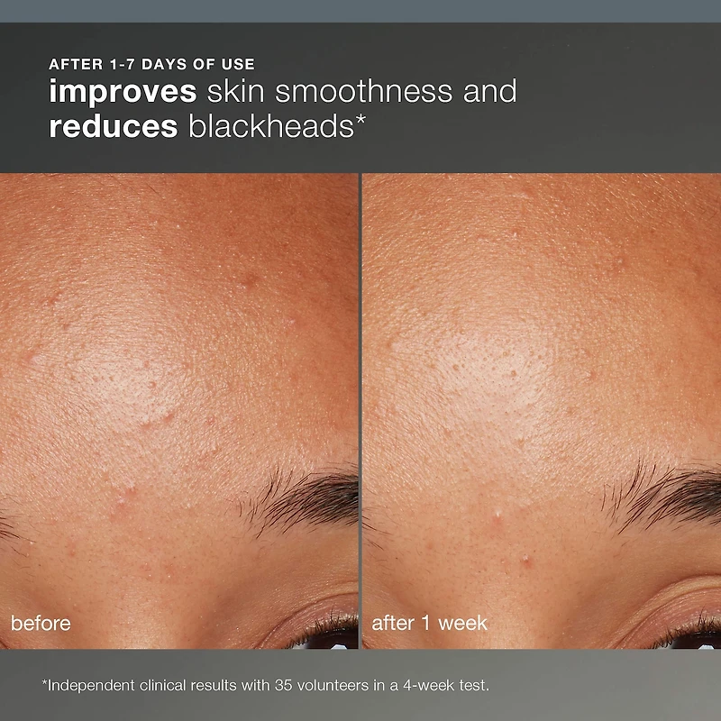 Daily Microfoliant Refillable Exfoliator