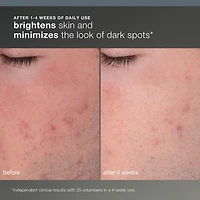 Daily Microfoliant Refillable Exfoliator
