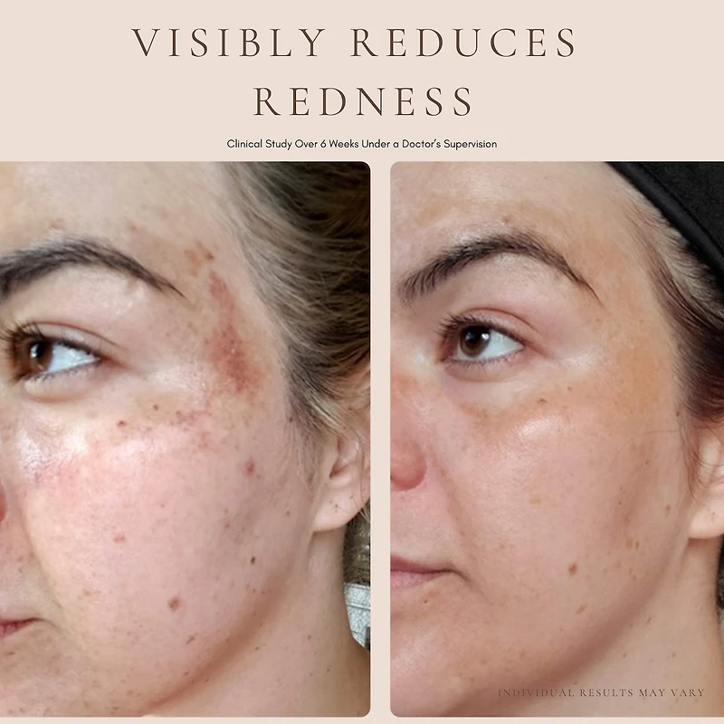 Luxury Beauty Serum Calming Treatment