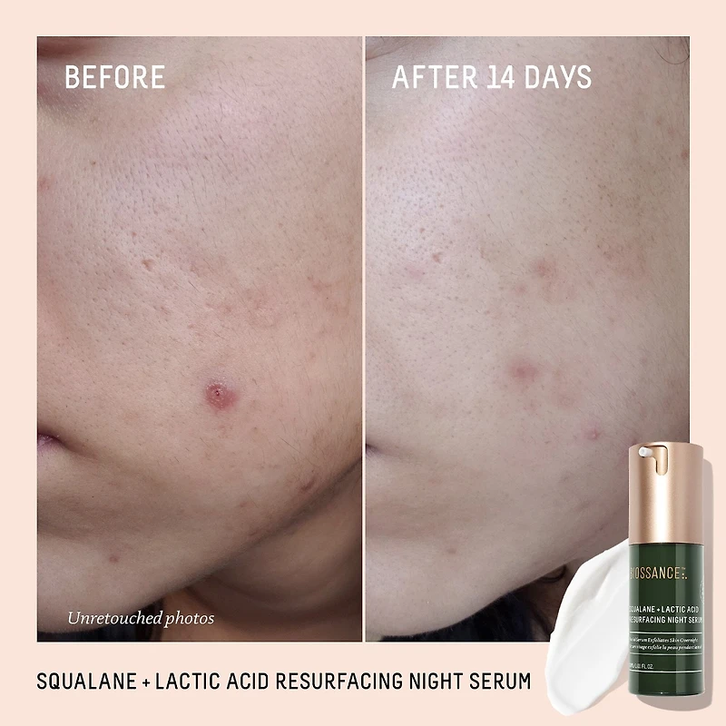 Squalane + 10% Lactic Acid Resurfacing Serum