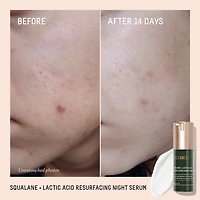 Squalane + 10% Lactic Acid Resurfacing Serum