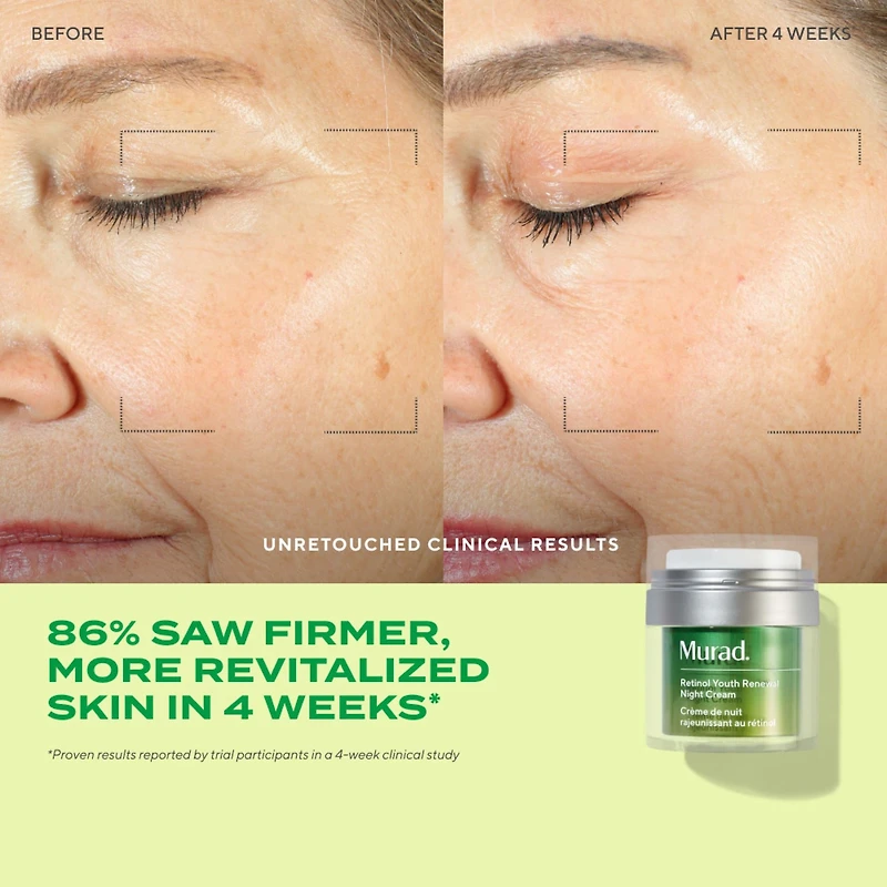 Crème de nuit régénérante au rétinol avec niacinamide et peptides				