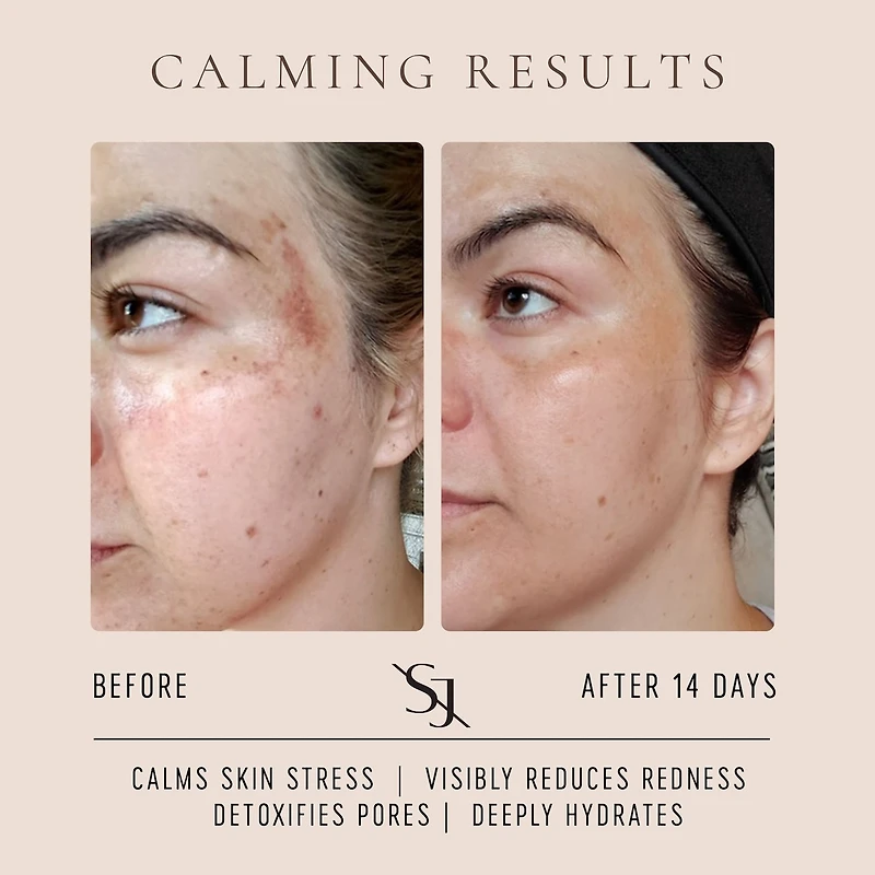 Luxury Beauty Serum Calming Treatment