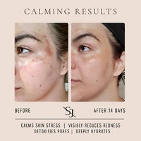 Luxury Beauty Serum Calming Treatment