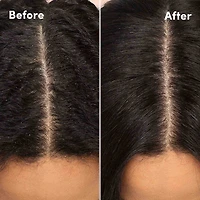 Scalp Care Soothing Scalp Lotion
