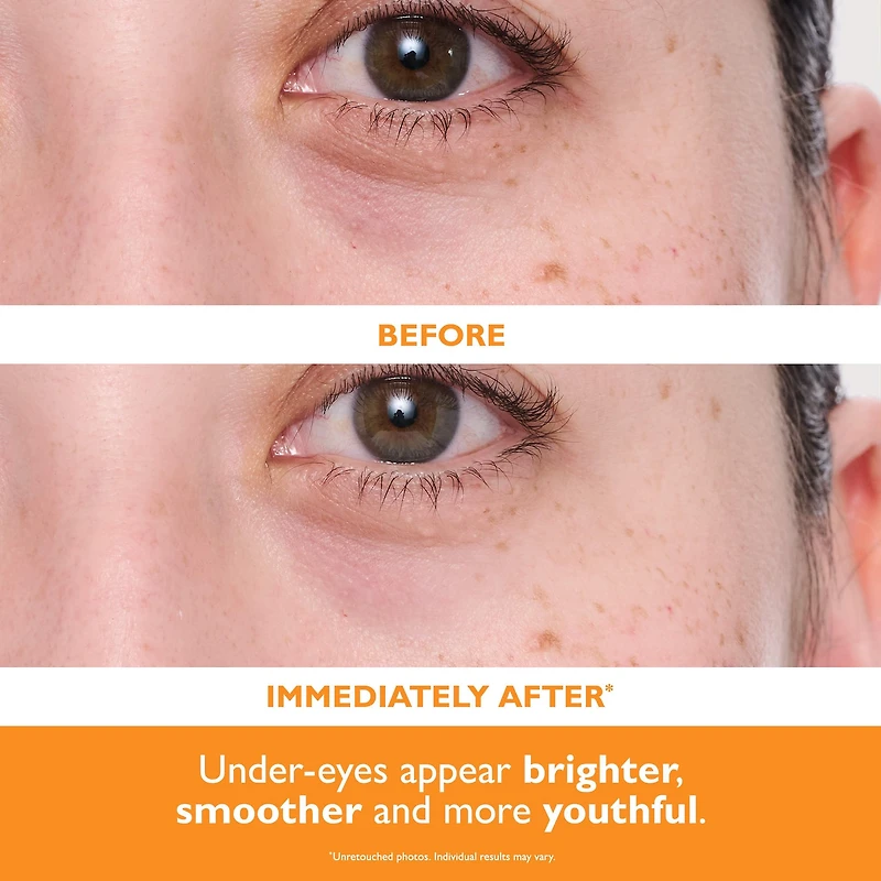Timbres de gel hydratant illuminant pour les yeux Potent-C™