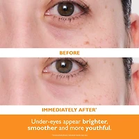 Timbres de gel hydratant illuminant pour les yeux Potent-C™