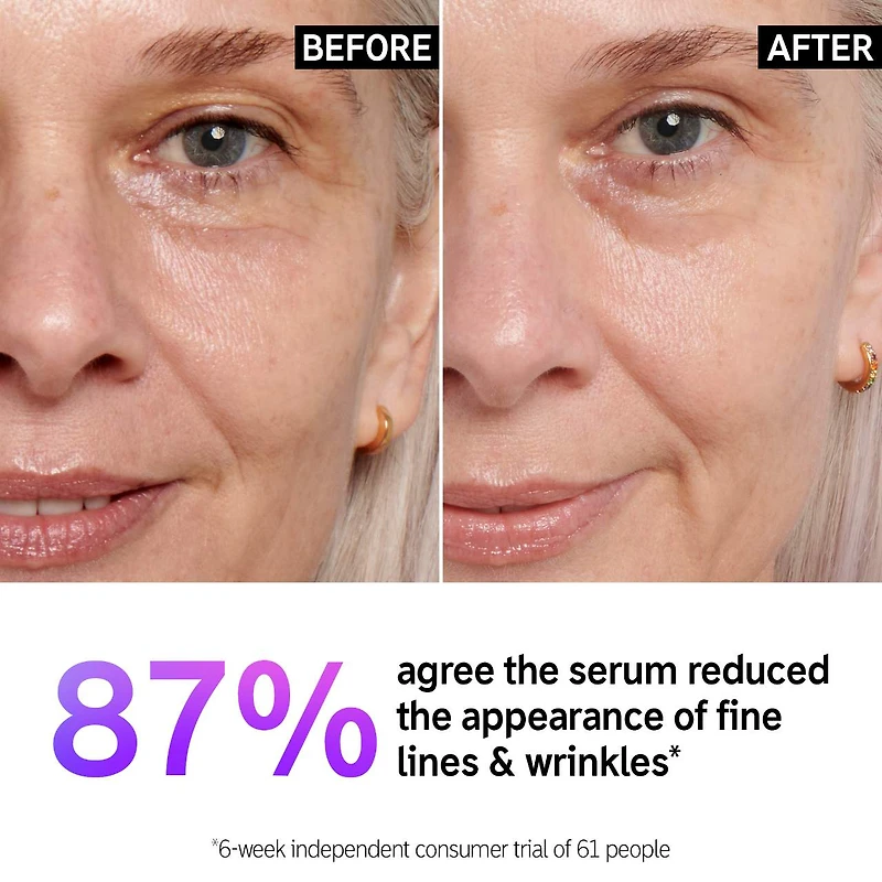 Retinol Fine Lines and Wrinkles Serum