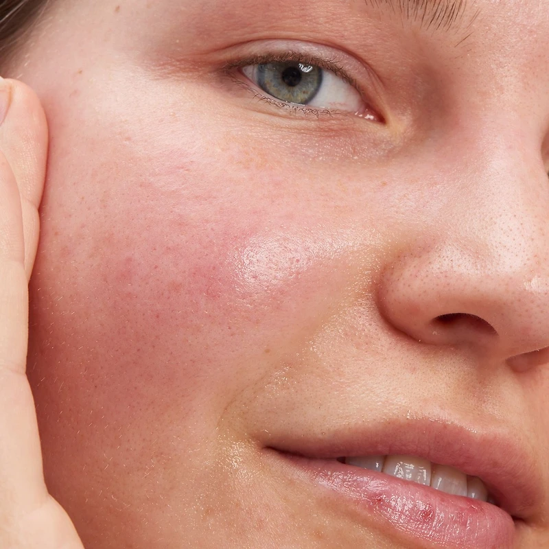 Glycolic Acid Exfoliating Toner