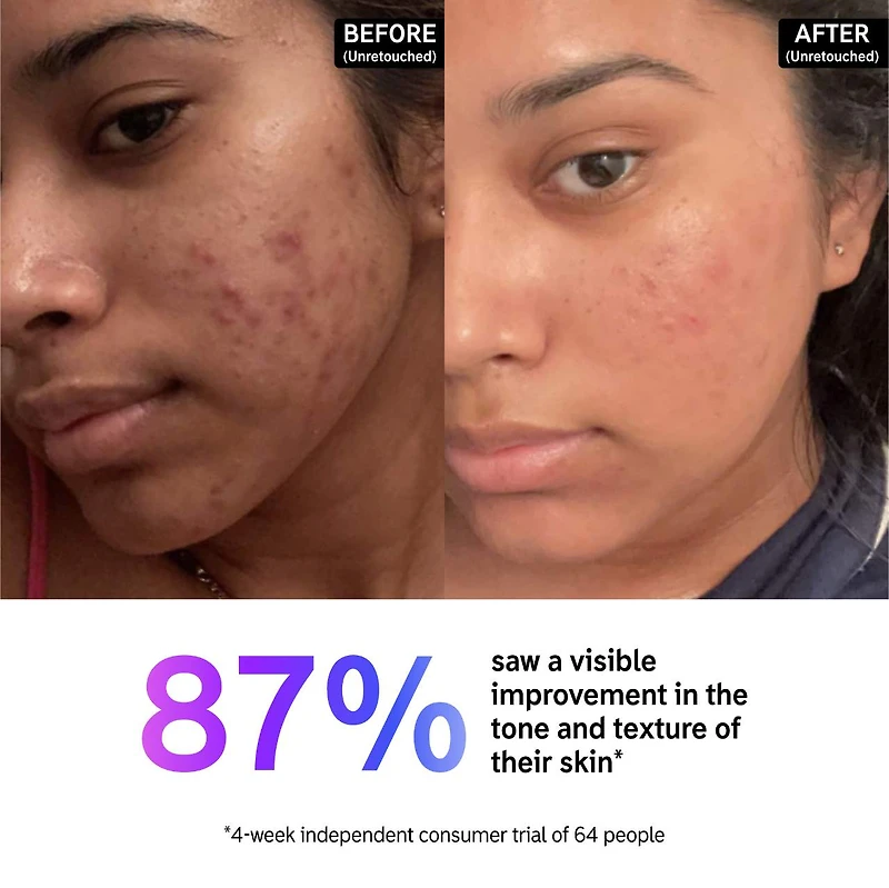 15% Vitamin C and EGF Brightening Serum