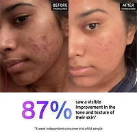 15% Vitamin C and EGF Brightening Serum