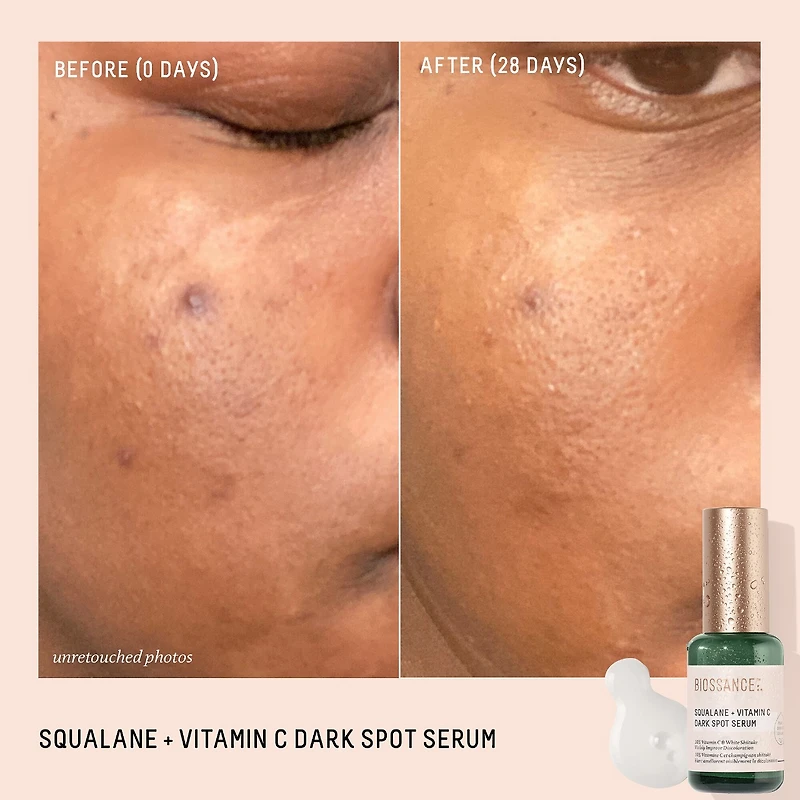 Sérum anti-taches pigmentaires à 10 % de vitamine C + squalane