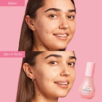 Sérum à la niacinamide Dew Drops Watermelon Glow
