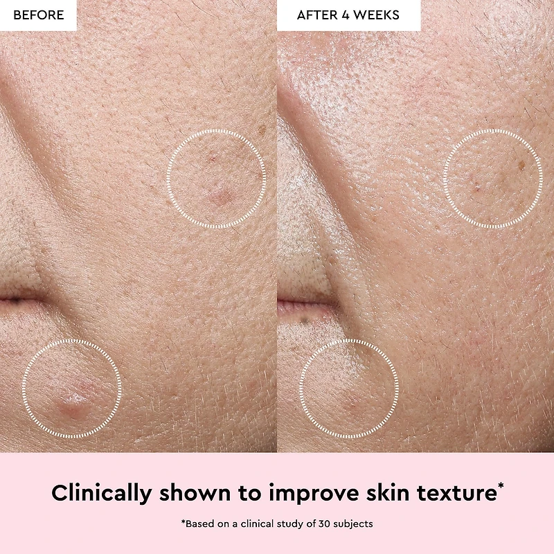 Watermelon Glow Niacinamide Dew Drops Multipurpose Brightening Serum