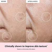 Watermelon Glow Niacinamide Dew Drops Multipurpose Brightening Serum