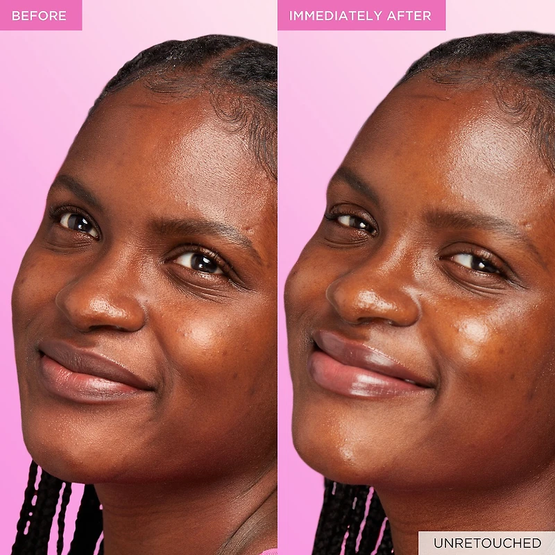 Sérum à la niacinamide Dew Drops Watermelon Glow
