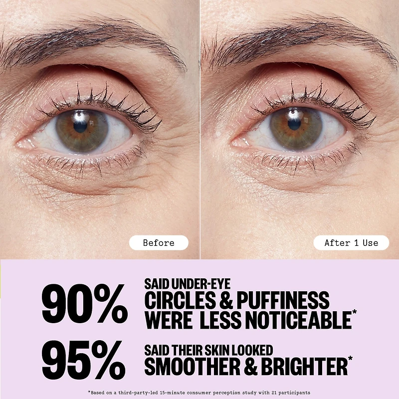Puffy Under-Eye Patches