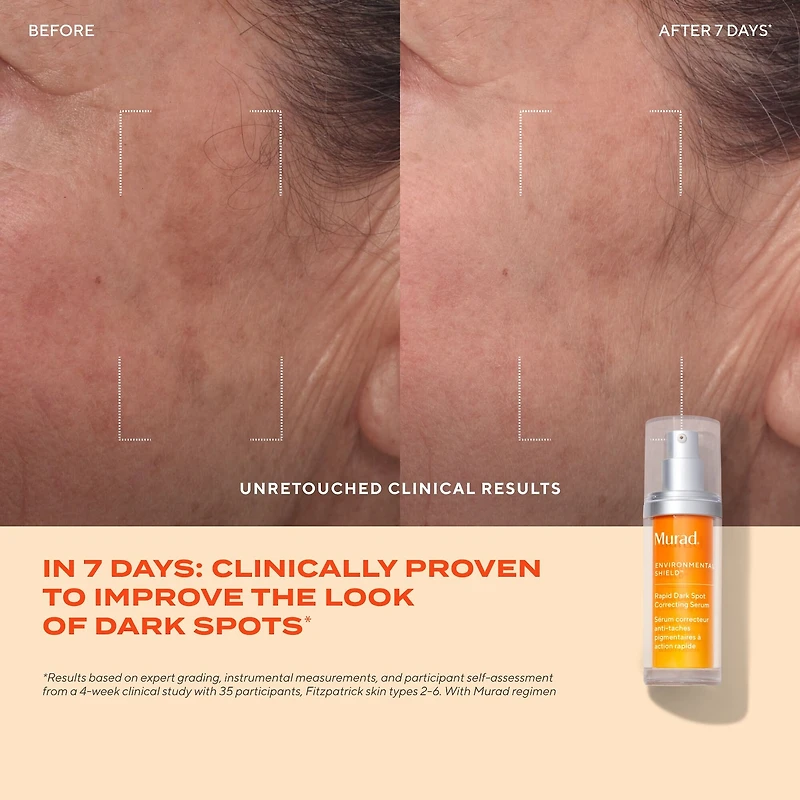 Rapid Dark Spot Correcting Serum with Glycolic and Tranexamic Acid